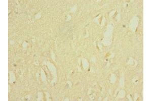 Immunohistochemistry of paraffin-embedded human brain tissue using ABIN7169928 at dilution of 1:100 (SCN8A antibody  (AA 1350-1440))