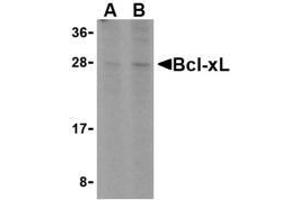 Western blot analysis of Bcl-xL in A549 cell lysates with AP30132PU-N Bcl-xL antibody at (A) 1 and (B) 2 μg/ml.