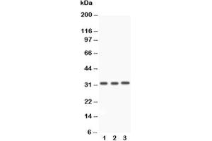 Western blot testing of Caspase-3 antibody and Lane 1:  rat liver;  2: rat thymus;  3: SMMC-7721