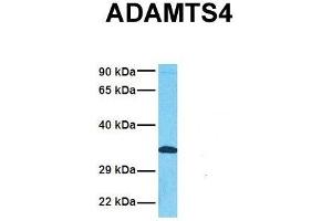 Host:  Rabbit  Target Name:  ADAMTS4  Sample Tissue:  Human Fetal Lung  Antibody Dilution:  1. (ADAMTS4 antibody  (N-Term))