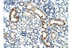 ZRSR2 antibody was used for immunohistochemistry at a concentration of 4-8 ug/ml to stain Epithelial cells of renal tubule (arrows) in Human Kidney.
