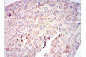 Immunohistochemistry (IHC) image for anti-V-Raf-1 Murine Leukemia Viral Oncogene Homolog 1 (RAF1) antibody (ABIN1844891)