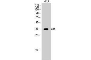 Western Blotting (WB) image for anti-P35 (N-Term) antibody (ABIN3176715) (P35 (N-Term) antibody)
