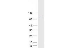 Validation with Western Blot