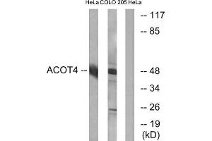 Western Blotting (WB) image for anti-Acyl-CoA Thioesterase 4 (ACOT4) (C-Term) antibody (ABIN1850684)