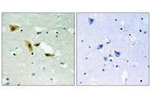 Immunohistochemistry analysis of paraffin-embedded human brain tissue using APLF (Ab-116) antibody. (APLF antibody  (Ser116))