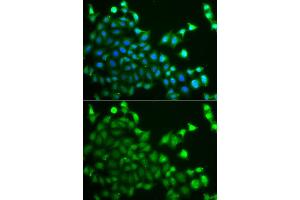 Immunofluorescence analysis of A549 cell using CBLC antibody. (CBLC antibody)
