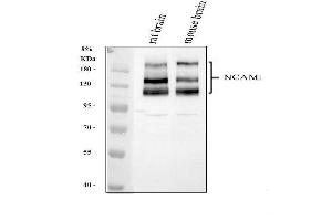 Western blot analysis of NCAM1 using anti-NCAM1 antibody (ABIN7600132). (CD56 antibody  (AA 152-690))