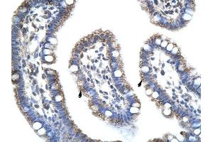STAU1 antibody was used for immunohistochemistry at a concentration of 4-8 ug/ml to stain Epithelial cells of intestinal villus (arrows) in Human Intestine. (STAU1/Staufen antibody)