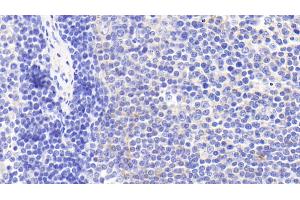 Detection of CHRM4 in Human Lymph node Tissue using Polyclonal Antibody to Cholinergic Receptor, Muscarinic 4 (CHRM4) (CHRM4 antibody)