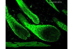 Immunohistochemistry analysis using Rabbit Anti-HSP70 Polyclonal Antibody . (HSP70 antibody  (PerCP))