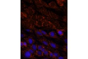 Immunofluorescence analysis of C6 cells using PI4KB antibody (ABIN7269287) at dilution of 1:100. (PI4KB antibody  (AA 560-801))