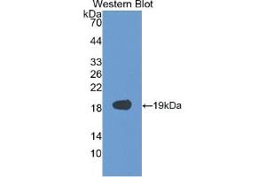 Western Blotting (WB) image for Vascular Endothelial Growth Factor A (VEGFA) ELISA Kit (ABIN6574143)