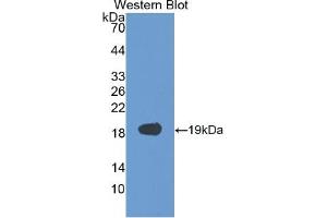 WB of Protein Standard: different control antibodies against Highly purified E. (VEGFA ELISA Kit)