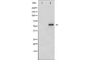 Western blot analysis of Elk1 phosphorylation expression in UV treated HeLa whole cell lysates,The lane on the left is treated with the antigen-specific peptide. (ELK1 antibody  (pSer383))