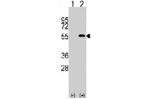 Western blot analysis of NUP50 (arrow) usingNUP50 polyclonal antibody . (NUP50 antibody  (C-Term))