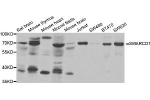 Western Blotting (WB) image for anti-SWI/SNF Related, Matrix Associated, Actin Dependent Regulator of Chromatin, Subfamily D, Member 1 (SMARCD1) antibody (ABIN1980326) (SMARCD1 antibody)
