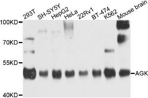 Western blot analysis of extracts of various cells, using AGK antibody. (Acylglycerol Kinase antibody)