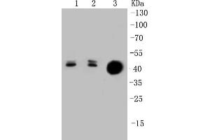 Lane 1: Lovo Cell lysates, Lane 2: HCT116 Cell lysates, Lane 3: CRC lysates, probed with Cytokeratin 20 (1F10) Monoclonal Antibody  at 1:1000 overnight at 4˚C. (KRT20 antibody)