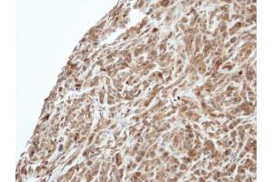 IHC-P Image Immunohistochemical analysis of paraffin-embedded SAS xenograft, using PIK3R3, antibody at 1:500 dilution. (PIK3R3 antibody  (Center))