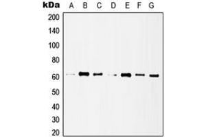 Western blot analysis of Histone Deacetylase 1 expression in MCF7 (A), HeLa (B), A431 (C), Jurkat (D), NIH3T3 (E), mouse lung (F), rat heart (G) whole cell lysates. (HDAC1 antibody  (C-Term))