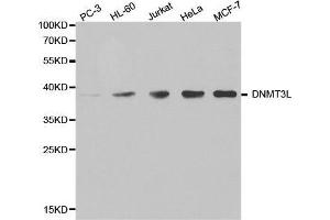 Western blot analysis of extracts of various cell lines, using DNMT3L antibody. (DNMT3L antibody  (AA 1-386))