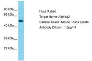 Image no. 1 for anti-Aldehyde Dehydrogenase 1 Family, Member A2 (ALDH1A2) (C-Term) antibody (ABIN6750430) (ALDH1A2 antibody  (C-Term))