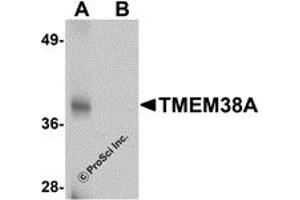 Western Blotting (WB) image for anti-Transmembrane Protein 38A (TMEM38A) (C-Term) antibody (ABIN1030754) (TMEM38A antibody  (C-Term))