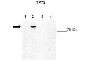 WB Suggested Anti-TP73 Antibody    Positive Control:  Lane1: 10ug untransfected H1299, Lane2: 10ug GFP-TAp73 transfected H1299, Lane3: 10ug GFP-DNp73 transfected H1299, Lane4: 10ug GFP-DBDp73 transfected H1299   Primary Antibody Dilution :   1:1000  Secondary Antibody :   Anti-rabbit-HRP   Secondry Antibody Dilution :   1:5000  Submitted by:  Francesca Grespi, VIB-Department for Molecular Biomedical Research, University of Gent (Tumor Protein p73 antibody  (N-Term))