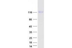 Western Blotting (WB) image for Nuclear Factor of Activated T-Cells, Cytoplasmic, Calcineurin-Dependent 2 (NFAT1) (Transcript Variant 2) protein (Myc-DYKDDDDK Tag) (ABIN2727213)
