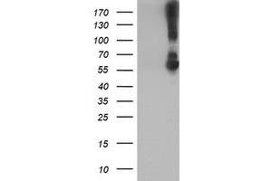 Western Blotting (WB) image for anti-Potassium Inwardly-Rectifying Channel, Subfamily J, Member 3 (KCNJ3) (AA 279-501) antibody (ABIN1491309) (KCNJ3 antibody  (AA 279-501))