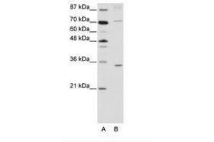 Image no. 1 for anti-Atonal Homolog 8 (ATOH8) (N-Term) antibody (ABIN202235)