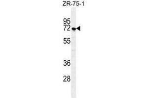 SUSD5 Antibody (C-term) western blot analysis in ZR-75-1 cell line lysates (35 µg/lane). (SUSD5 antibody  (C-Term))