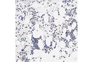 Immunohistochemical staining (Formalin-fixed paraffin-embedded sections) of human bone marrow with T polyclonal antibody  shows moderate nuclear positivity in a subset of bone marrow poietic cells at 1:20-1:50 dilution. (T Antigen antibody)