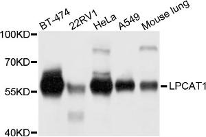 Western blot analysis of extracts of various cell lines, using LPCAT1 antibody (ABIN5972886) at 1/1000 dilution. (LPCAT1 antibody)