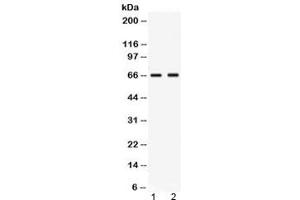 Western blot testing of human 1) MCF7 and 2) MM453 lysate with Nectin-4 antibody at 0.
