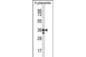 Mouse Mst4 Antibody (Center) (ABIN657993 and ABIN2846939) western blot analysis in human placenta tissue lysates (35 μg/lane). (STK26/MST4 antibody  (AA 271-299))