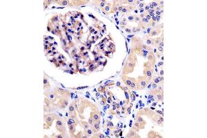 Antibody staining ROR1 in human kidney tissue sections by Immunohistochemistry (IHC-P - paraformaldehyde-fixed, paraffin-embedded sections).