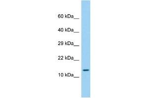 Host: Rabbit Target Name: LEPROTL1 Sample Type: Fetal Liver lysates Antibody Dilution: 1. (LEPROTL1 antibody  (N-Term))