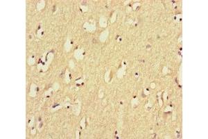 Immunohistochemistry of paraffin-embedded human brain tissue using ABIN7164461 at dilution of 1:100