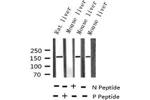 Western blot analysis of Phospho-EGFR (Tyr1110) expression in various lysates (EGFR antibody  (pTyr1110))