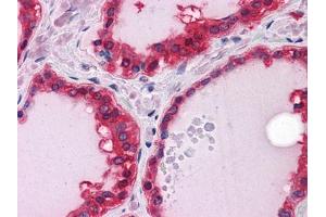 Immunohistochemical analysis of paraffin-embedded human Thyroid tissues using ST13 mouse mAb (HSC70 Interacting Protein HIP antibody)