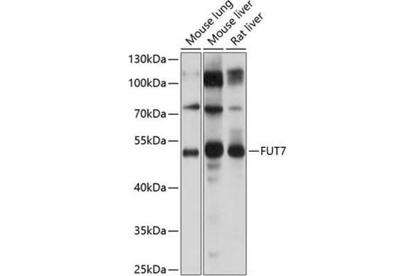 FUT7 antibody  (AA 100-200)