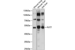 Western blot analysis of extracts of various cell lines, using FUT7 Antibody (ABIN6133982, ABIN6140825, ABIN6140826 and ABIN6224983) at 1:1000 dilution.