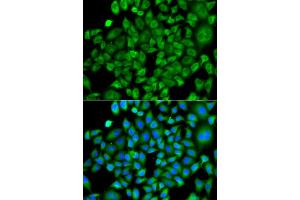 Immunofluorescence analysis of A549 cells using NAA50 antibody. (NAA50 antibody)