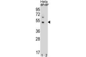 Western blot analysis of DNAJB6 (arrow) pre-incubated without (lane 1) and with (lane 2) blocking peptide in Hela cell line lysate using DNAJB6  Antibody  (1:60/250 dilution).