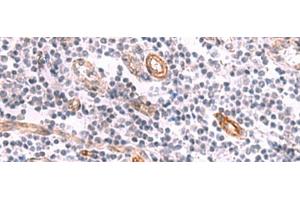 Immunohistochemistry of paraffin-embedded Human tonsil tissue using KCNK15 Polyclonal Antibody at dilution of 1:45(x200) (KCNK15 antibody)