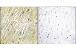 Immunohistochemistry analysis of paraffin-embedded human heart tissue, using M-CK Antibody. (CKM antibody  (AA 10-59))