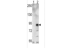 Western blot analysis of EphA5 (arrow) using rabbit polyclonal EphA5 Antibody (ABIN391894 and ABIN2841713). (EPH Receptor A5 antibody)