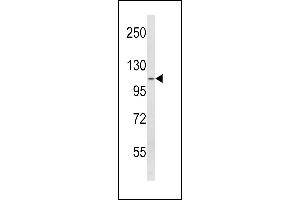 SPINK5 antibody  (N-Term)